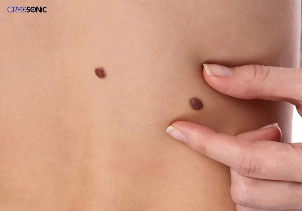 Infection Risk and Poor Aftercare Walsall