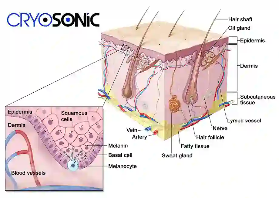 How Cryotherapy Stimulates Melanocyte Activity Walsall
